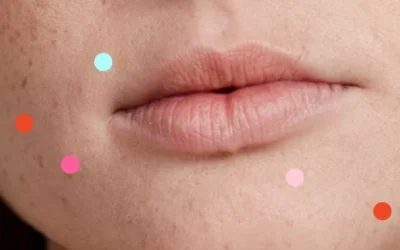 Why Am I Breaking Out? 15 Acne Causes You Need to Know About